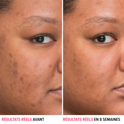 Bye Bye Dark Spots - Sérum anti-taches à la niacinamide
