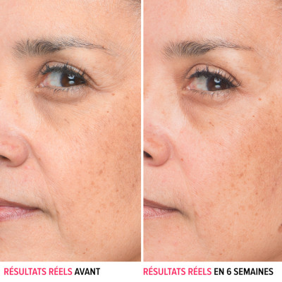Bye Bye Lines - Sérum anti-rides à l'acide hyaluronique