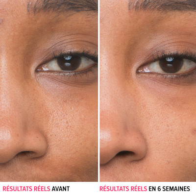 Bye Bye Pores - Sérum anti-pores visibles à l'acide glycolique