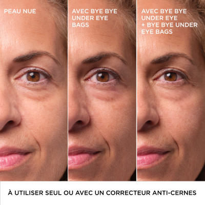 Bye Bye Under Eye Bags - Traitement instantané pour les poches