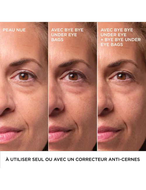 Bye Bye Under Eye Bags