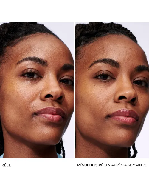 Confidence in a Gel Cream